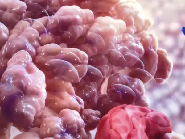 Descubren cómo el cáncer puede resistir la inmunoterapia