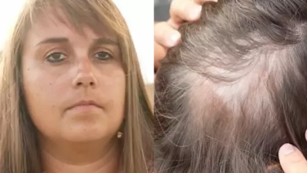 Le dijeron que tenía un tumor cerebral terminal: pasó 11 años en quimioterapia y nunca tuvo cáncer